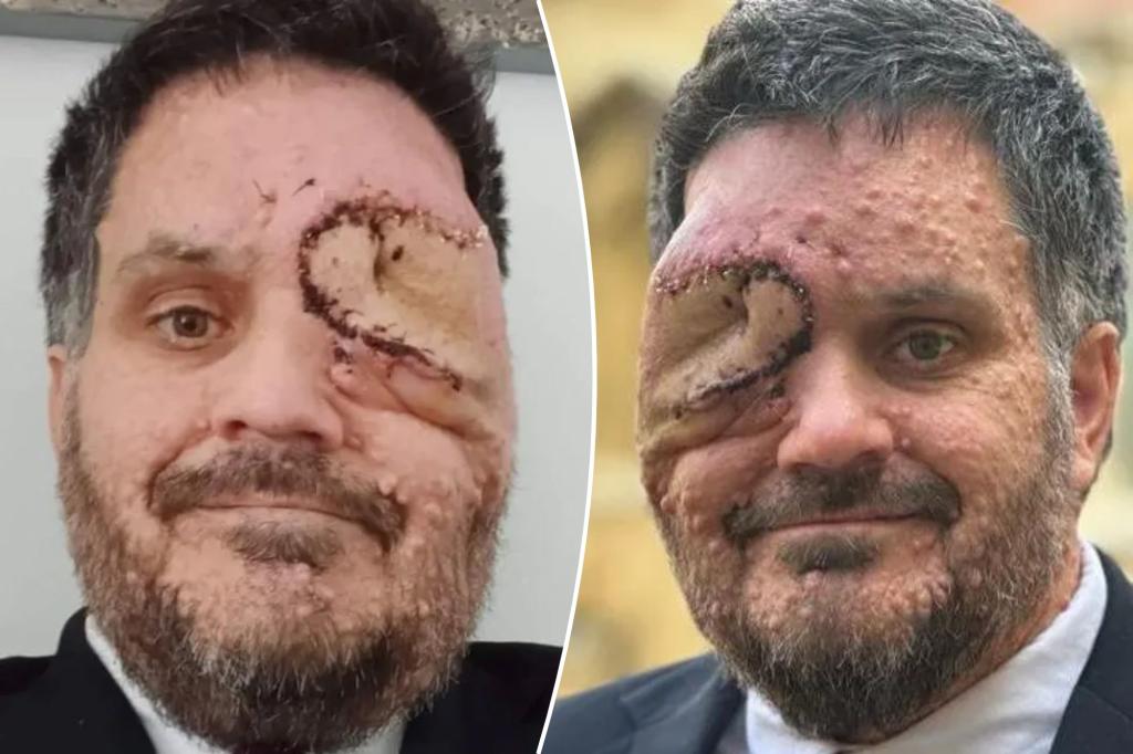 Man with facial disfigurement asked to leave restaurant for 'scaring customers': 'I wasn't even sitting down'